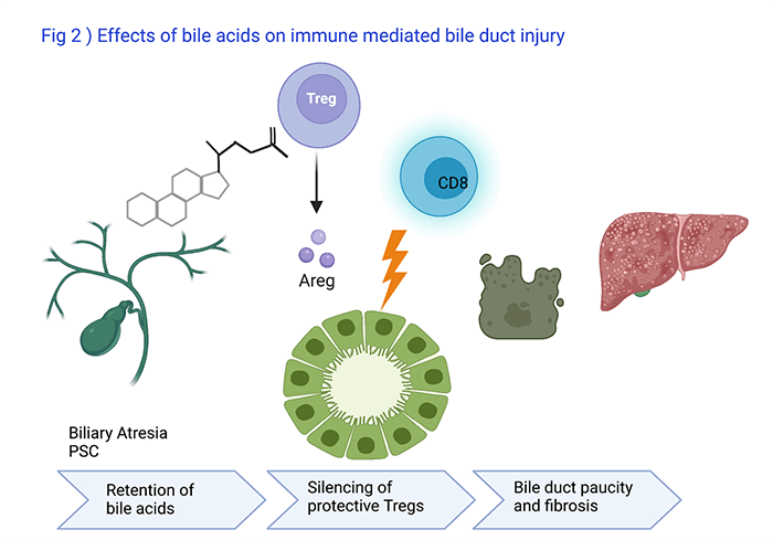 Bile Acids effects on Immune Mediated Bile Duct Injury